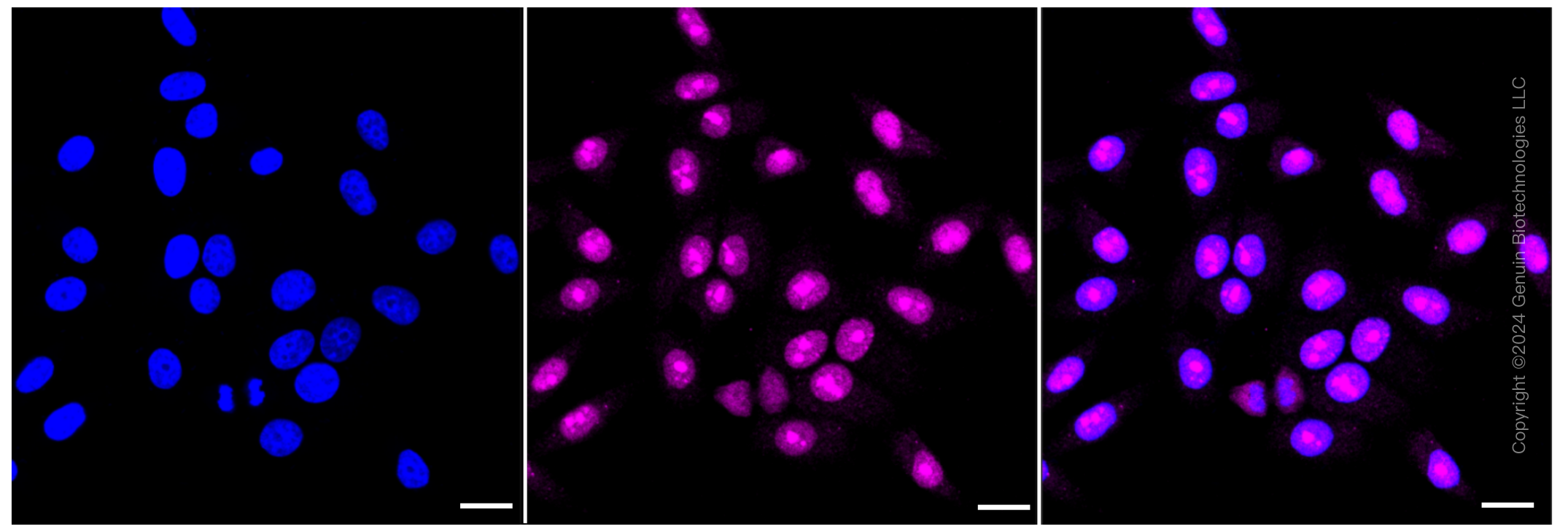 KD-Validated Anti-High mobility group box 2 Rabbit Monoclonal Antibody ABG1447