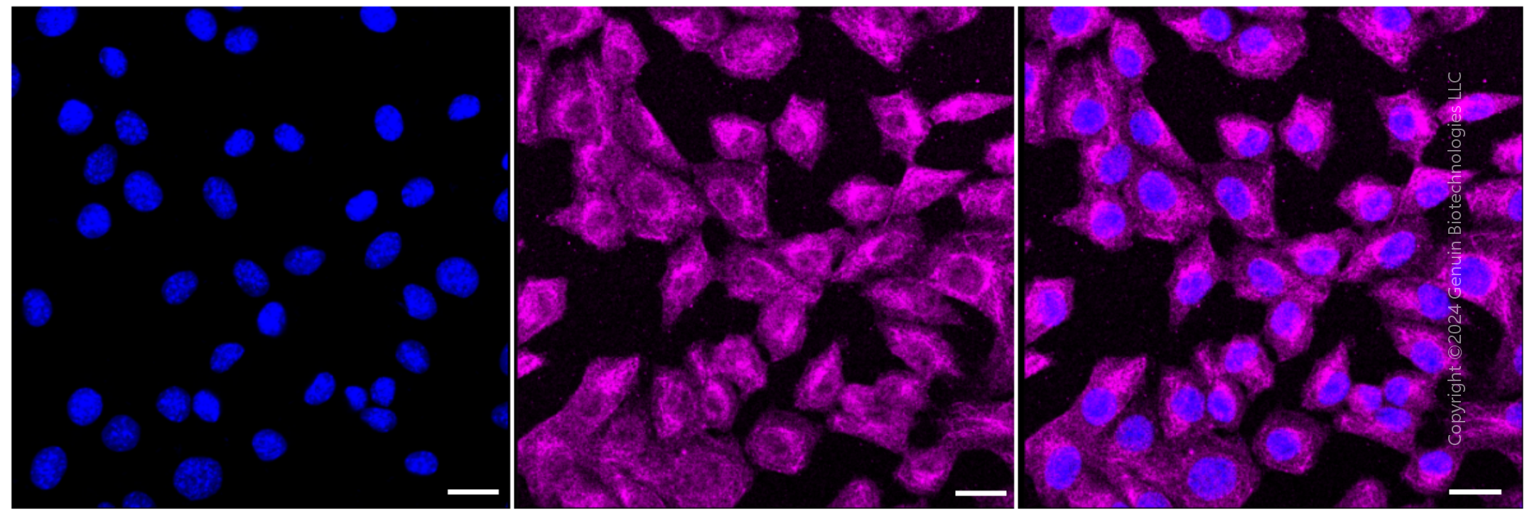 KD-Validated Anti-ERK1/2 Rabbit Monoclonal Antibody ABG1449