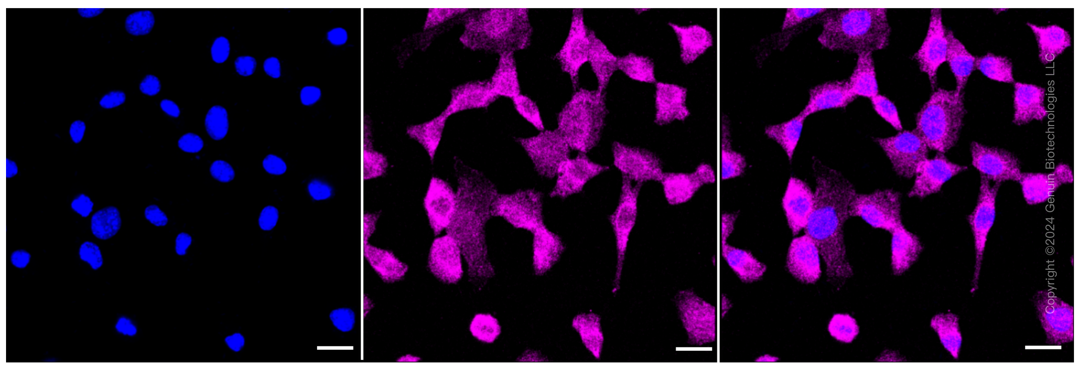 KD-Validated Anti-p38 MAPK Rabbit Monoclonal Antibody ABG1450