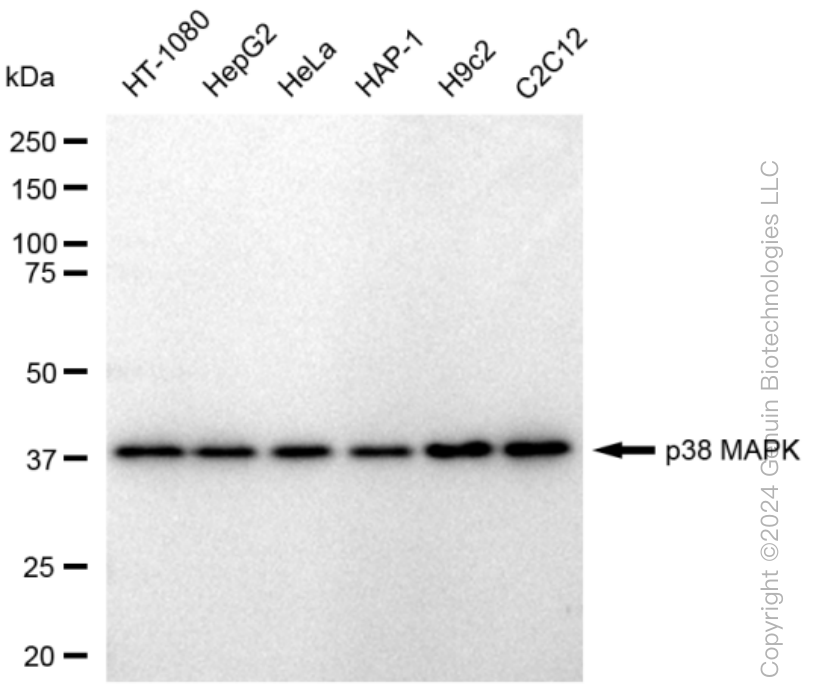 KD-Validated Anti-p38 MAPK Rabbit Monoclonal Antibody ABG1450