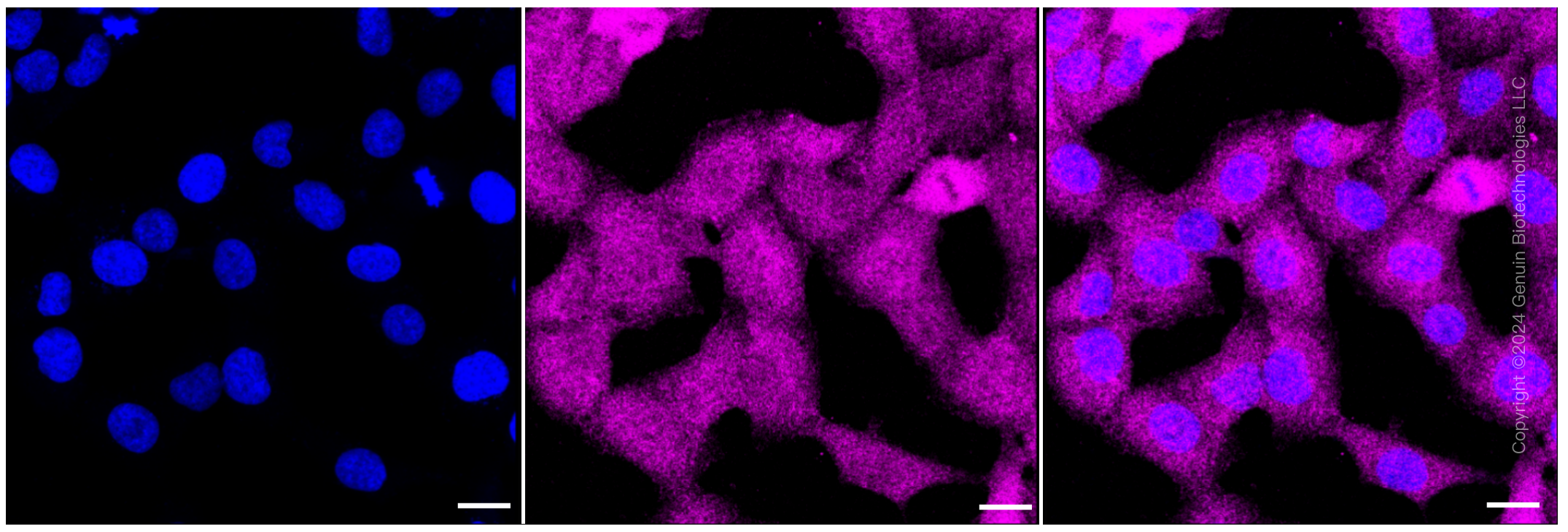 KD-Validated Anti-p38 MAPK Rabbit Monoclonal Antibody ABG1451