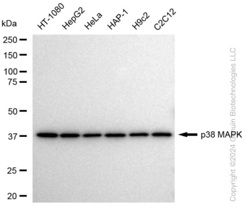 KD-Validated Anti-p38 MAPK Rabbit Monoclonal Antibody ABG1451