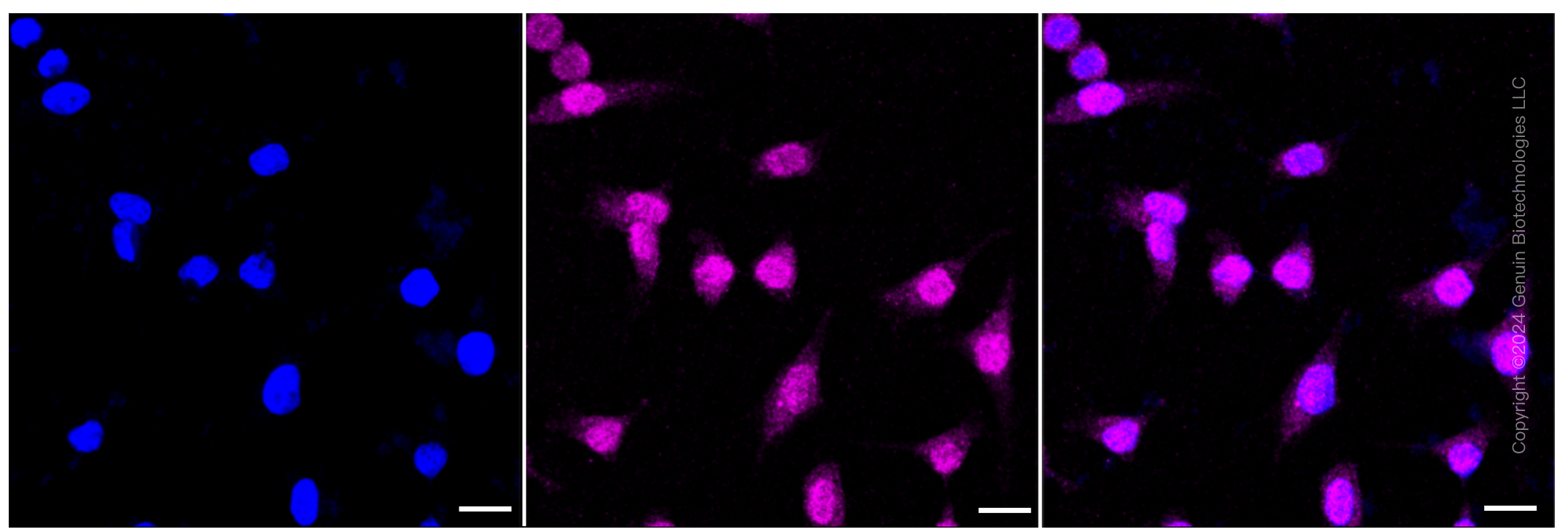 KD-Validated Anti-p38 MAPK Rabbit Monoclonal Antibody ABG1452