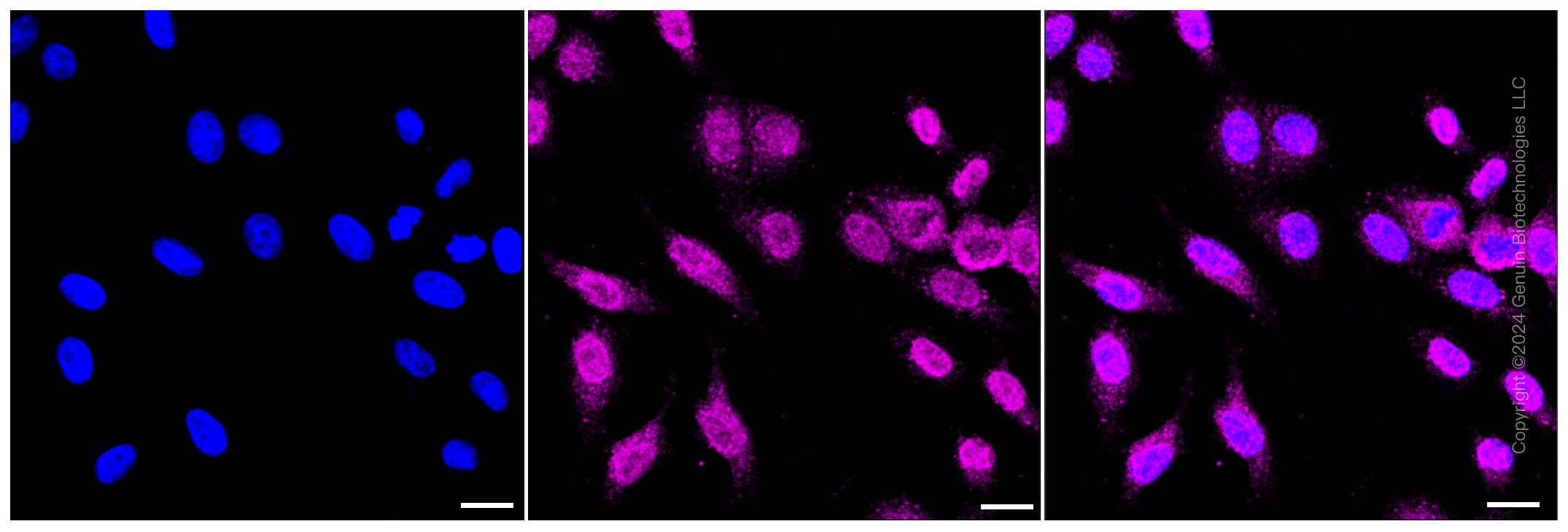 KD-Validated Anti-Methylmalonyl-CoA mutase Rabbit Monoclonal Antibody ABG1453