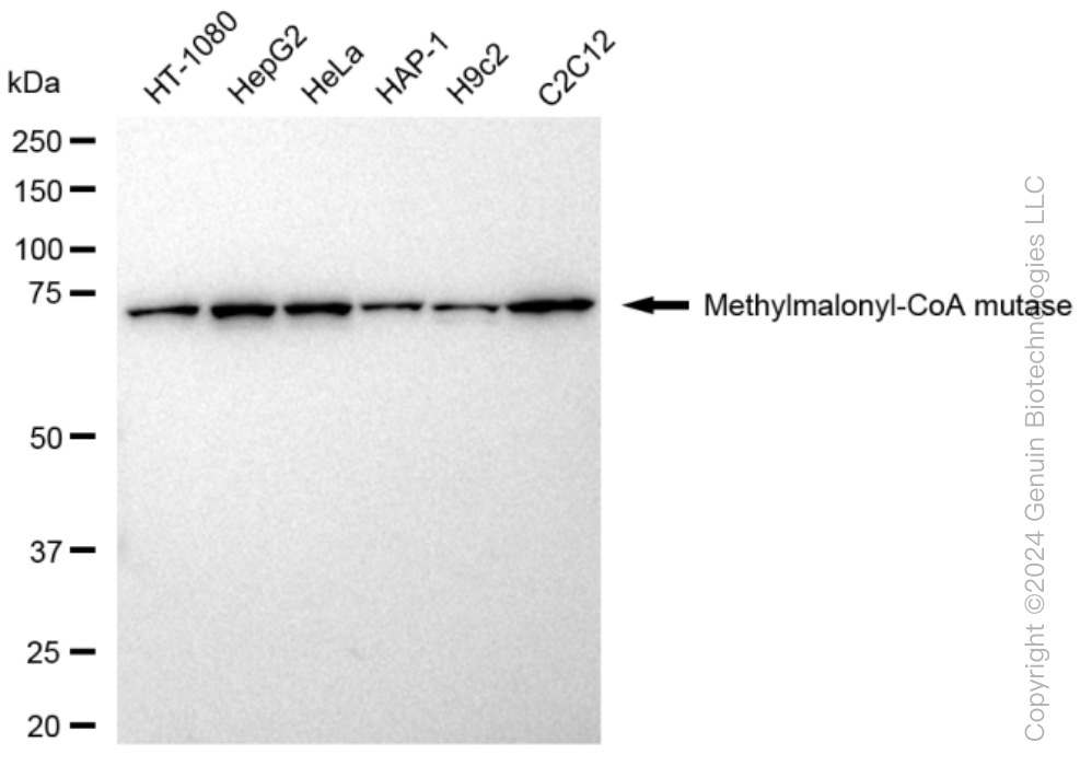 KD-Validated Anti-Methylmalonyl-CoA mutase Rabbit Monoclonal Antibody ABG1453