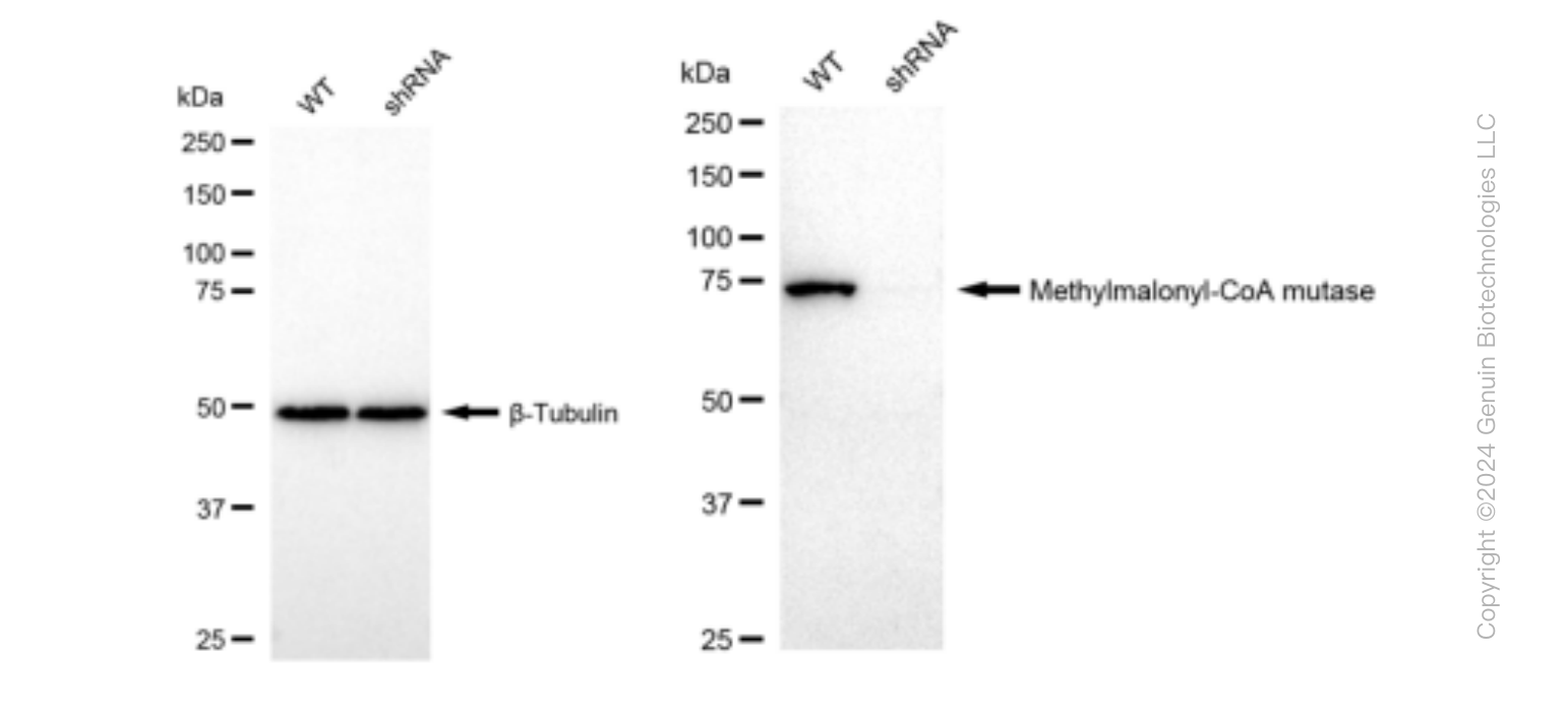 KD-Validated Anti-Methylmalonyl-CoA mutase Rabbit Monoclonal Antibody ABG1453