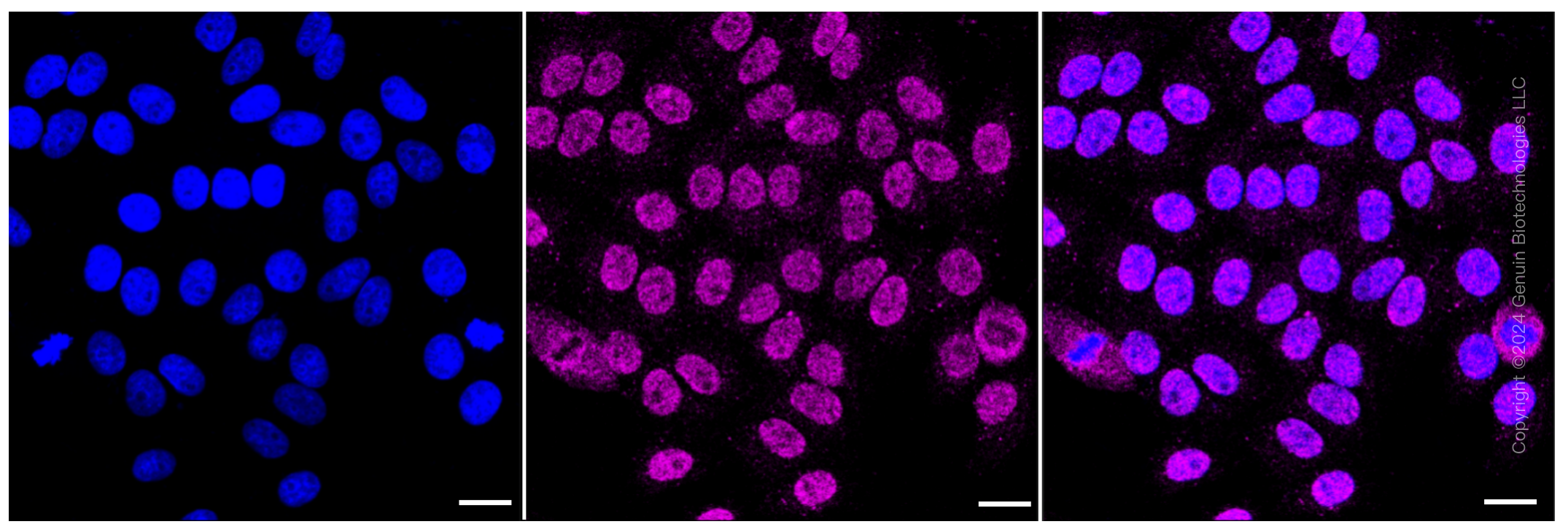 KD-Validated Anti-Methylmalonyl-CoA mutase Rabbit Monoclonal Antibody ABG1454