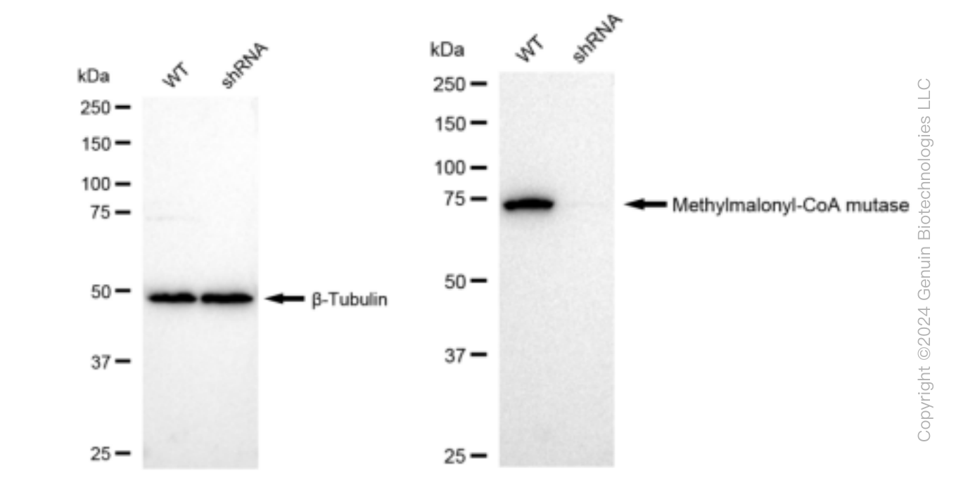 KD-Validated Anti-Methylmalonyl-CoA mutase Rabbit Monoclonal Antibody ABG1454