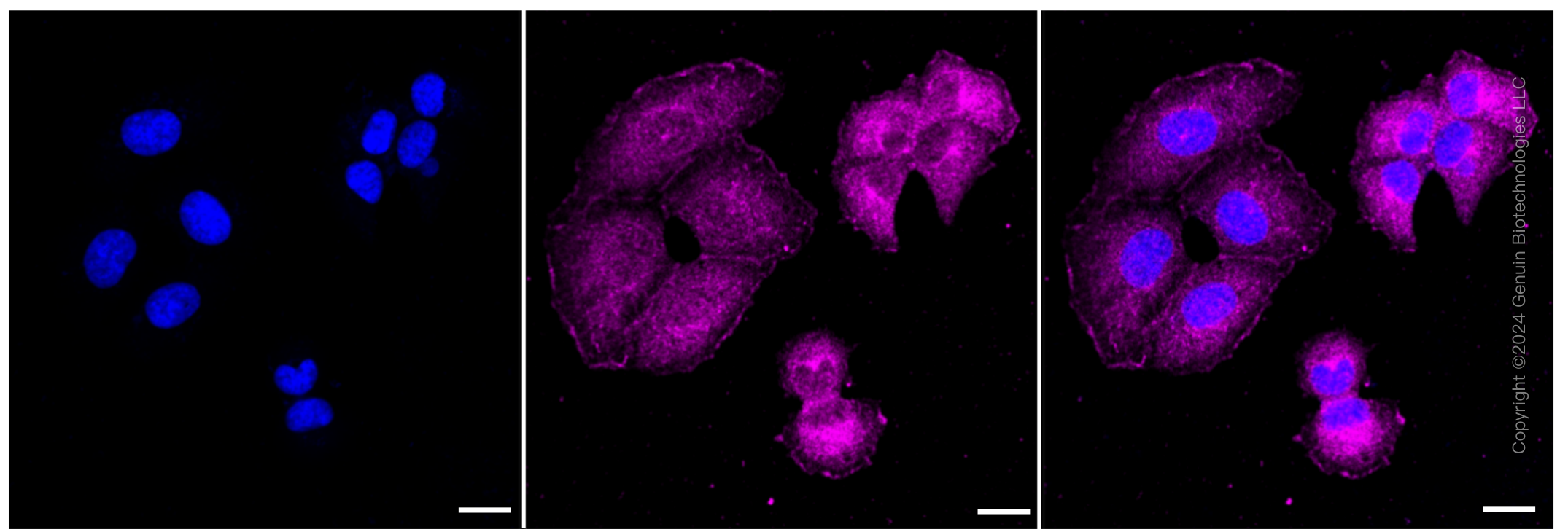 KD-Validated Anti-Methylthioadenosine phosphorylase Rabbit Monoclonal Antibody ABG1455