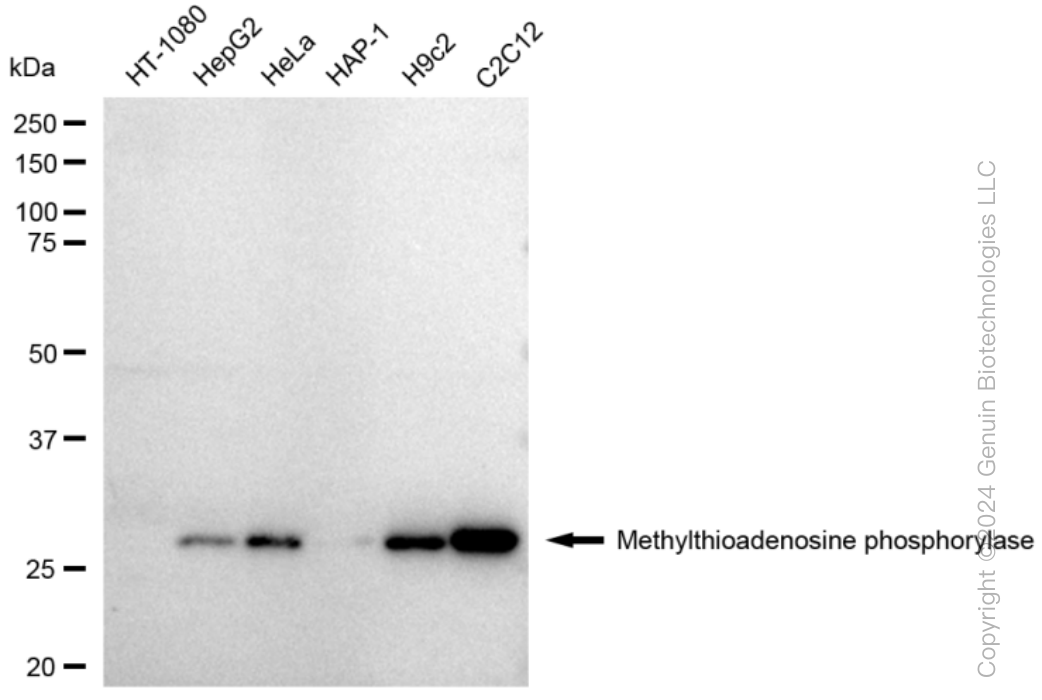 KD-Validated Anti-Methylthioadenosine phosphorylase Rabbit Monoclonal Antibody ABG1455