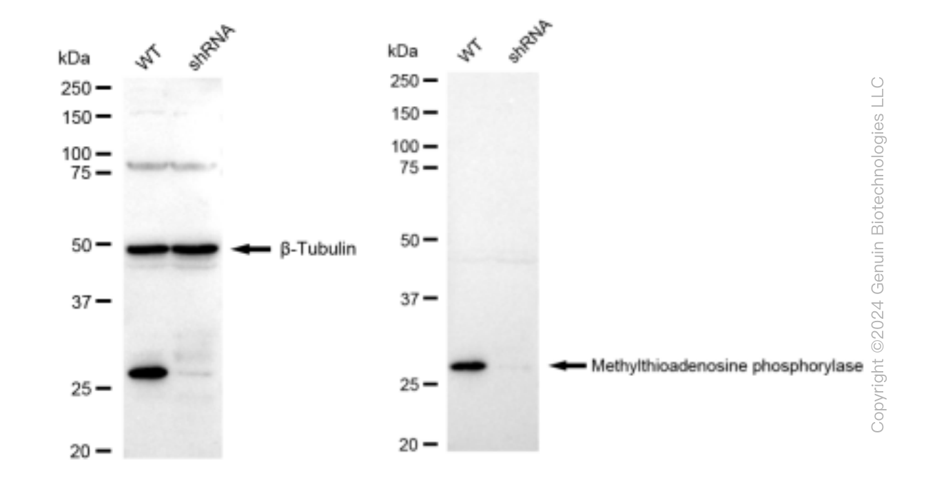 KD-Validated Anti-Methylthioadenosine phosphorylase Rabbit Monoclonal Antibody ABG1455
