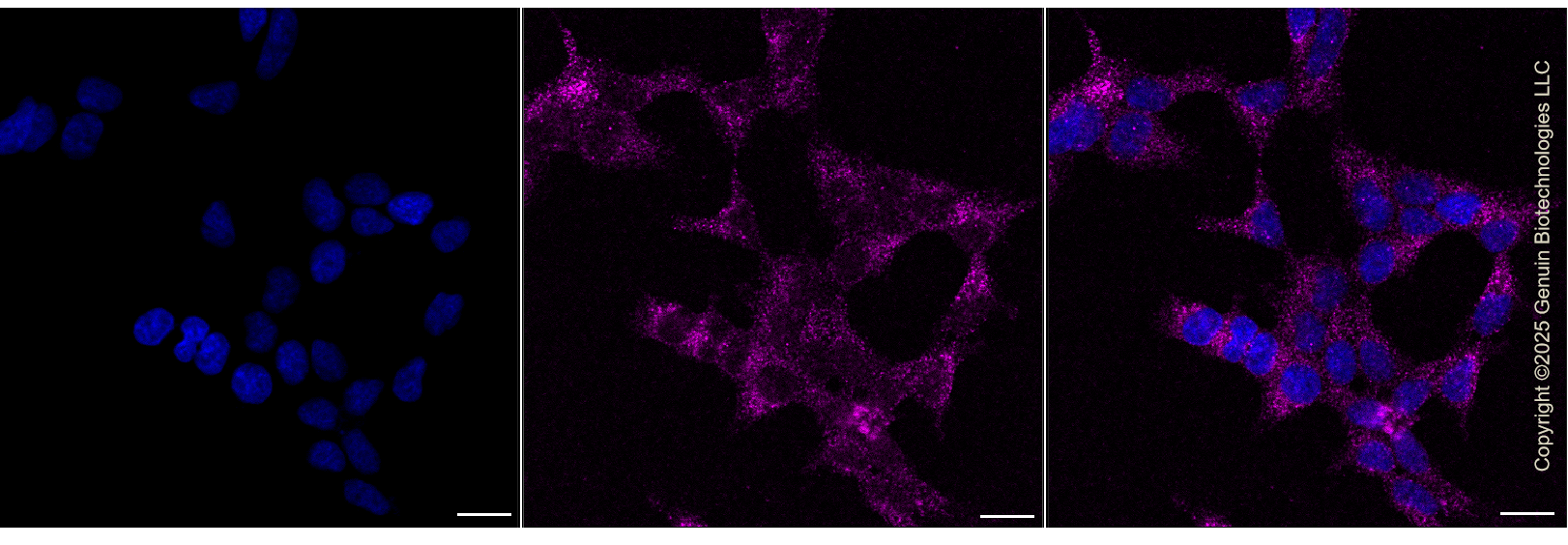 KD-Validated Anti-AGPS Rabbit Monoclonal Antibody ABG1458