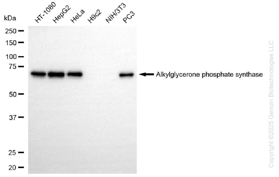 KD-Validated Anti-AGPS Rabbit Monoclonal Antibody ABG1458