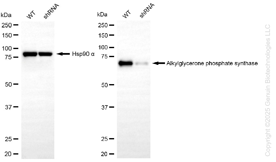 KD-Validated Anti-AGPS Rabbit Monoclonal Antibody ABG1458