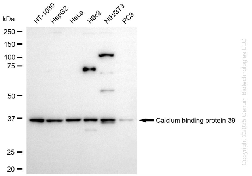 KD-Validated Anti-CAB39 Rabbit Monoclonal Antibody ABG1462