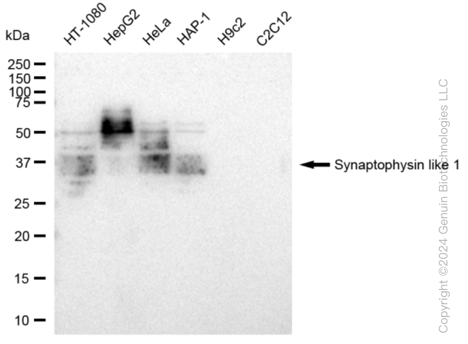 KD-Validated Anti-Synaptophysin like 1 Rabbit Monoclonal Antibody ABG1466