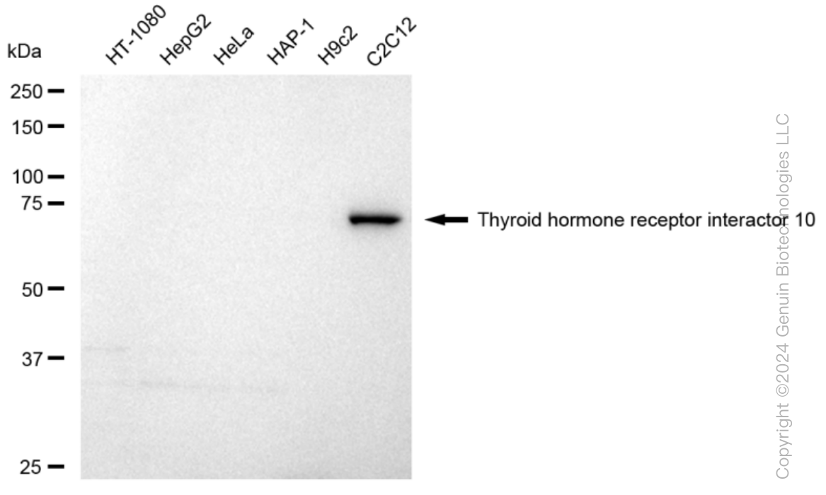KD-Validated Anti-Thyroid hormone receptor interactor 10 Rabbit Monoclonal Antibody ABG1468