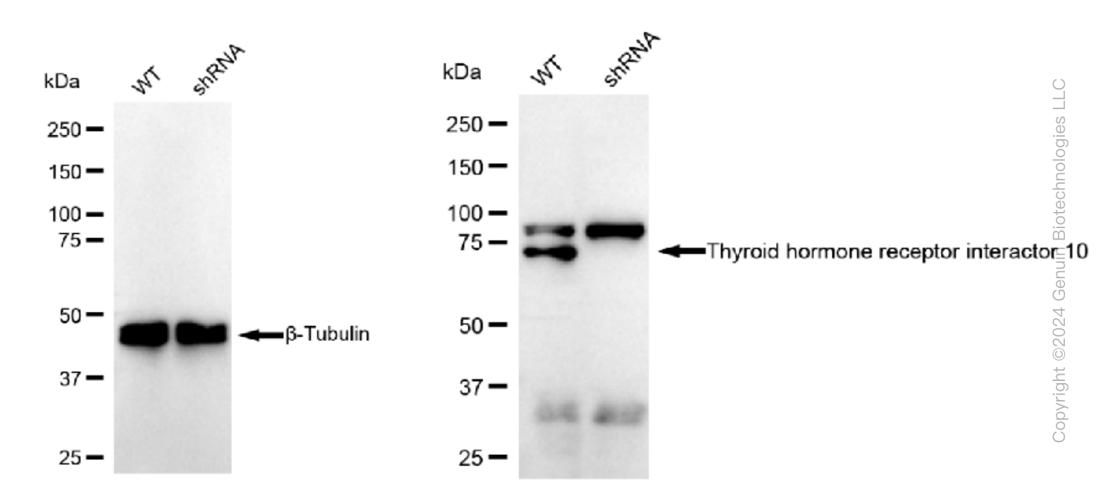 KD-Validated Anti-Thyroid hormone receptor interactor 10 Rabbit Monoclonal Antibody ABG1468