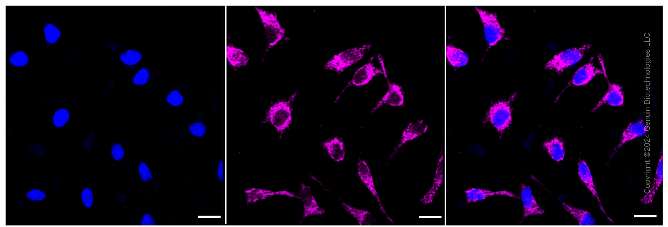 KD-Validated Anti-TSFM Rabbit Monoclonal Antibody ABG1469