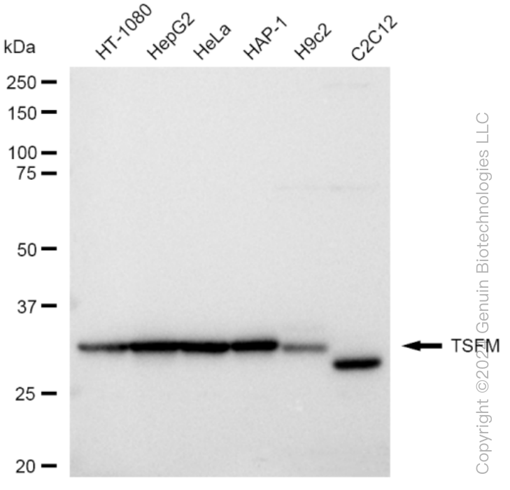 KD-Validated Anti-TSFM Rabbit Monoclonal Antibody ABG1469