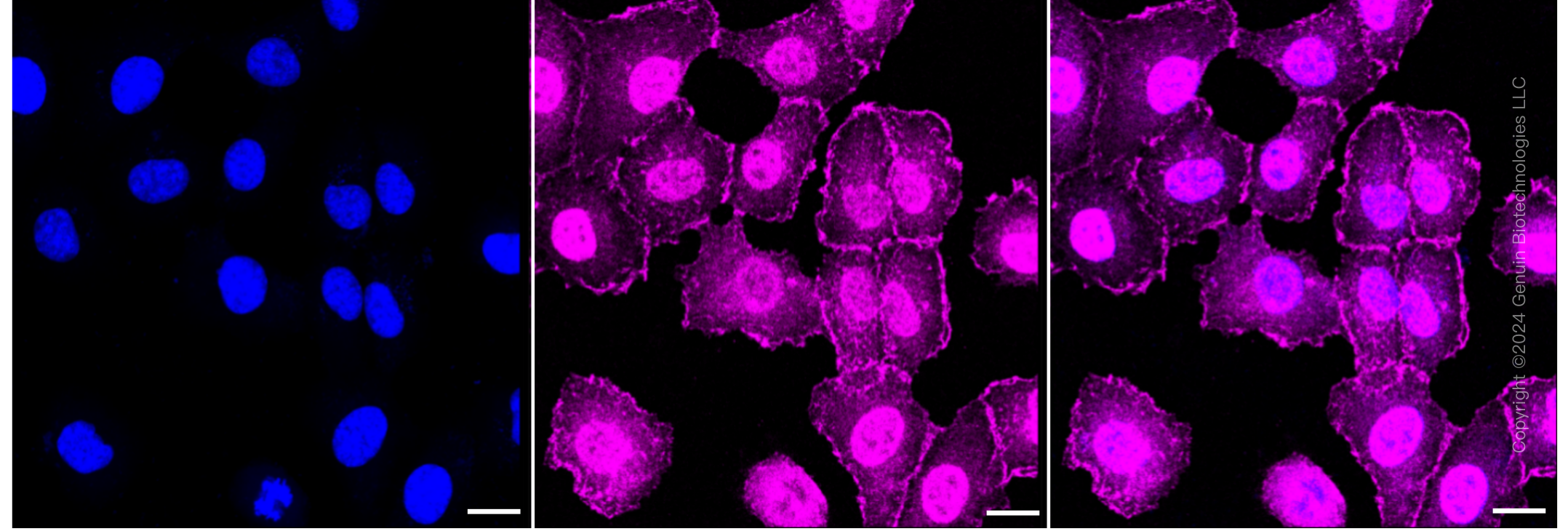 KD-Validated Anti-Vasodilator stimulated phosphoprotein Rabbit Monoclonal Antibody ABG1470