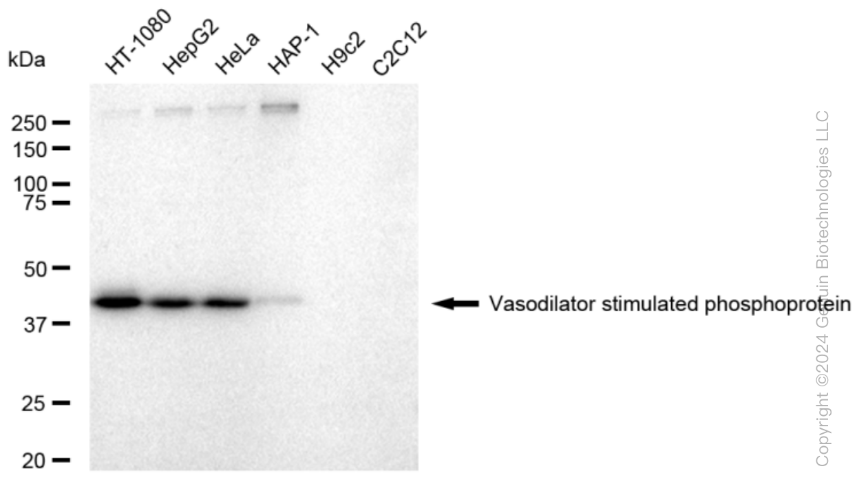 KD-Validated Anti-Vasodilator stimulated phosphoprotein Rabbit Monoclonal Antibody ABG1470