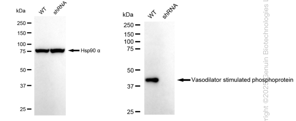 KD-Validated Anti-Vasodilator stimulated phosphoprotein Rabbit Monoclonal Antibody ABG1470