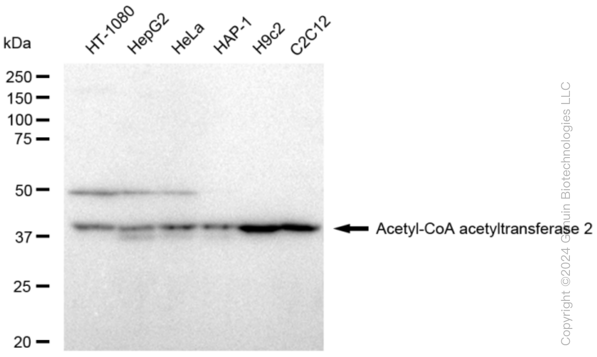 KD-Validated Anti-Acetyl-CoA acetyltransferase 2 Rabbit Monoclonal Antibody ABG1475
