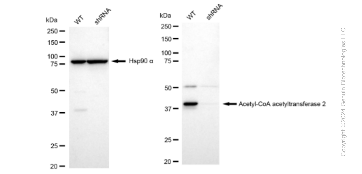 KD-Validated Anti-Acetyl-CoA acetyltransferase 2 Rabbit Monoclonal Antibody ABG1475