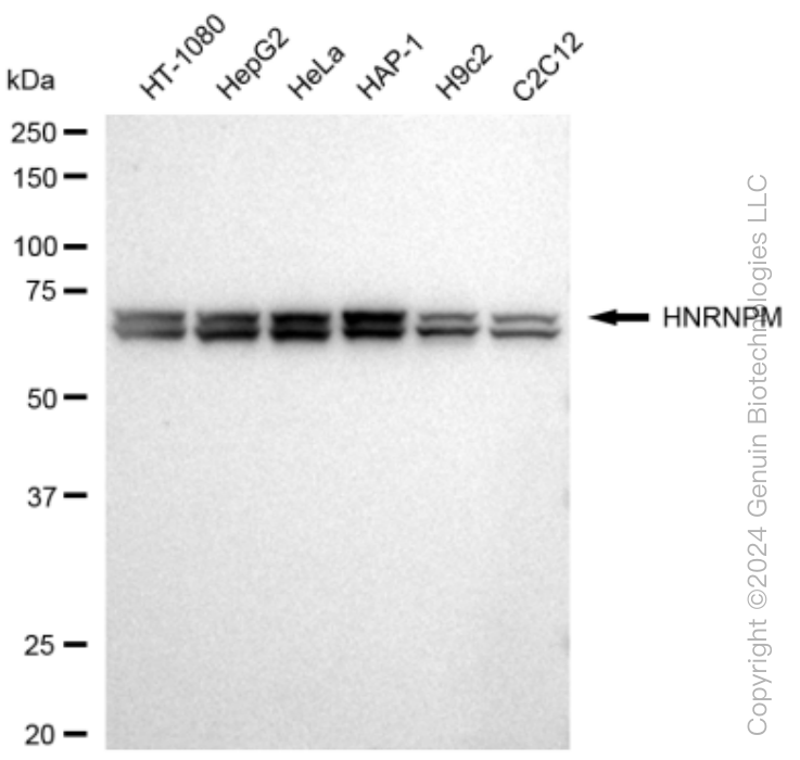 KD-Validated Anti-HNRNPM Rabbit Monoclonal Antibody ABG1480