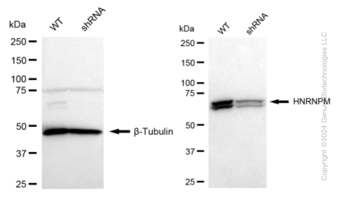 KD-Validated Anti-HNRNPM Rabbit Monoclonal Antibody ABG1480