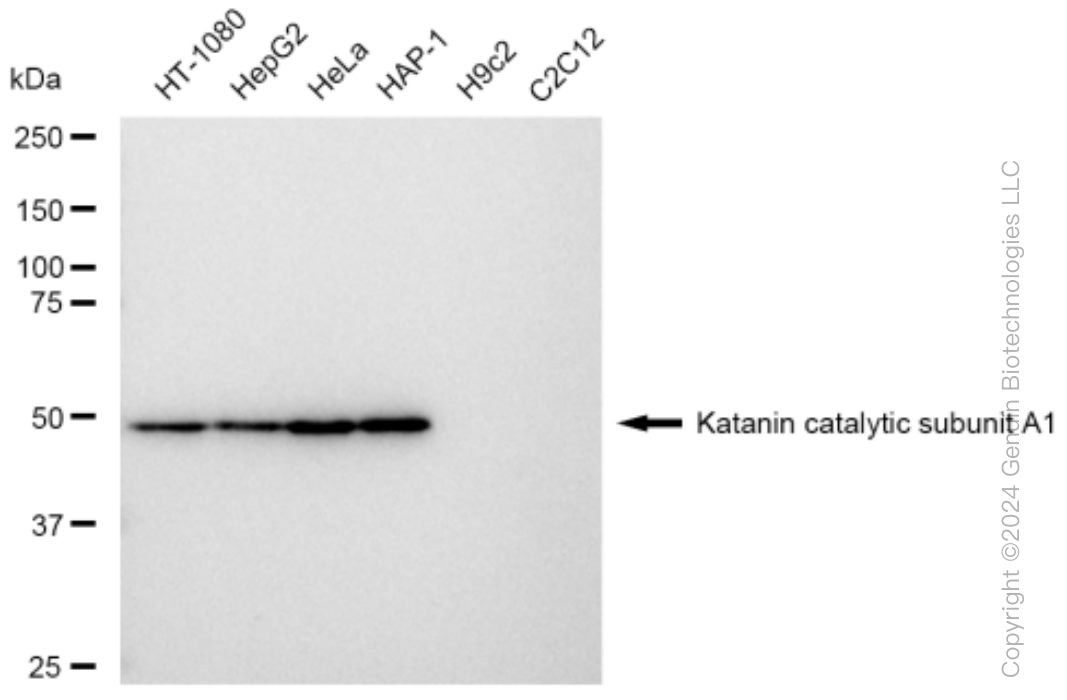KD-Validated Anti-Katanin catalytic subunit A1 Rabbit Monoclonal Antibody ABG1481