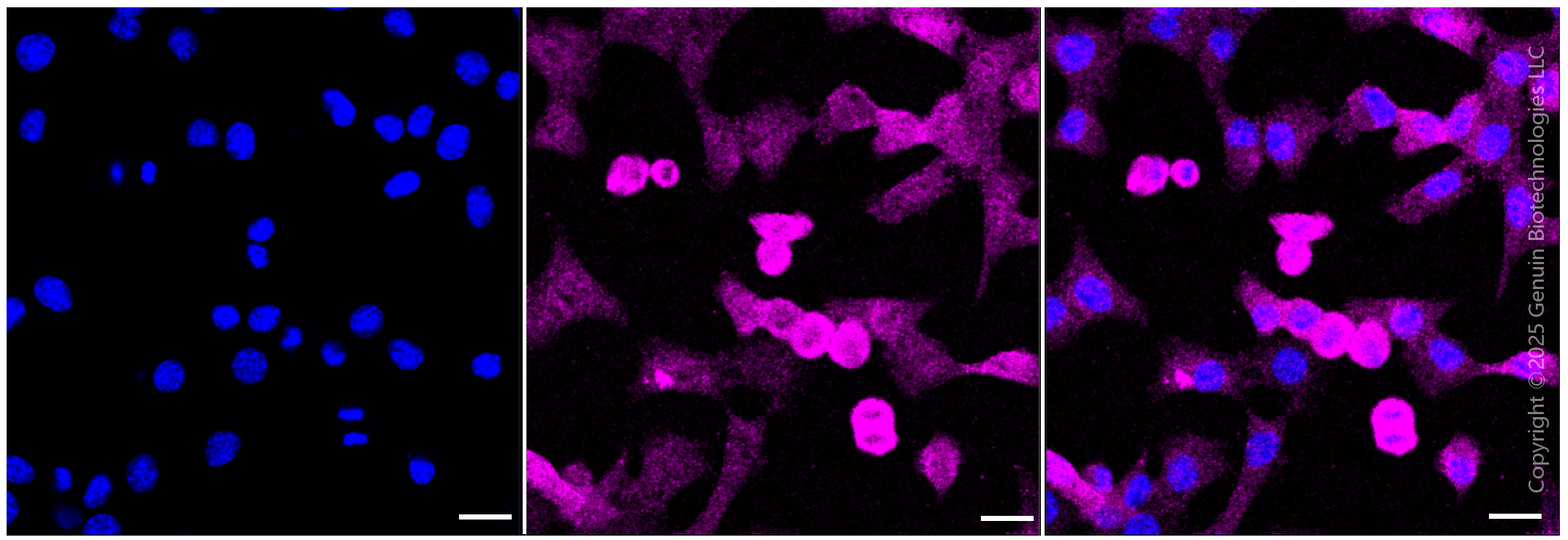 KD-Validated Anti-Galectin 3 Rabbit Monoclonal Antibody ABG1482