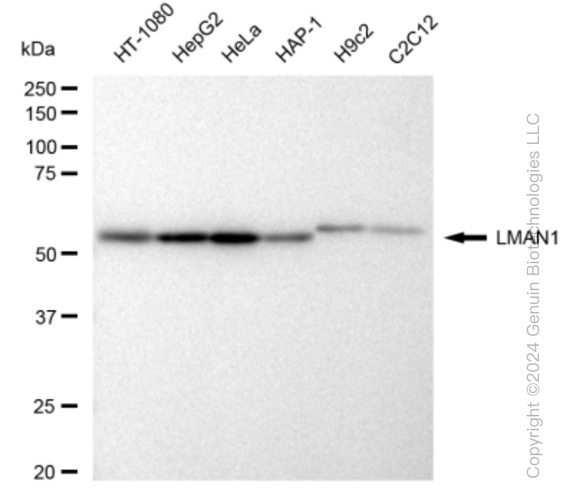 KD-Validated Anti-LMAN1 Rabbit Monoclonal Antibody ABG1483