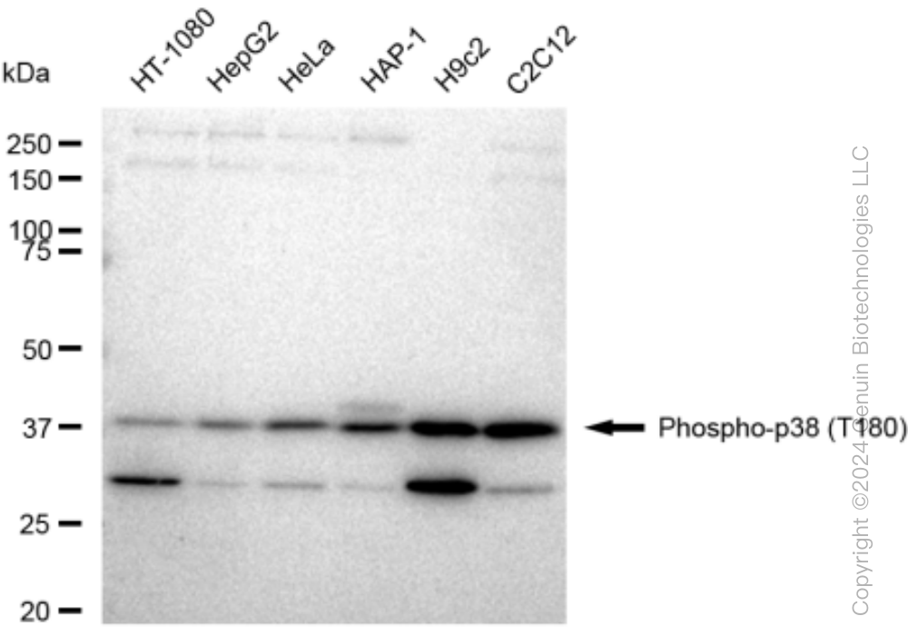 KD-Validated Anti-Phospho-p38 (T180) Rabbit Monoclonal Antibody ABG1484