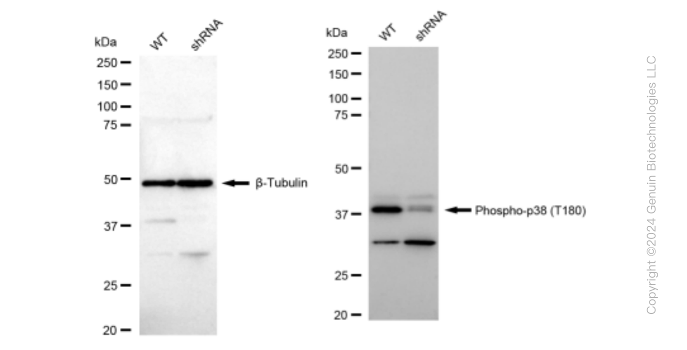 KD-Validated Anti-Phospho-p38 (T180) Rabbit Monoclonal Antibody ABG1484