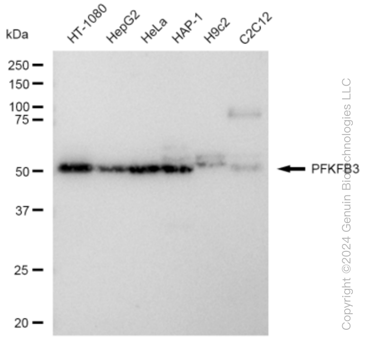 KD-Validated Anti-PFKFB3 Rabbit Monoclonal Antibody ABG1486