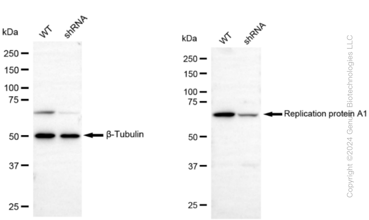 KD-Validated Anti-Replication protein A1 Rabbit Monoclonal Antibody ABG1488
