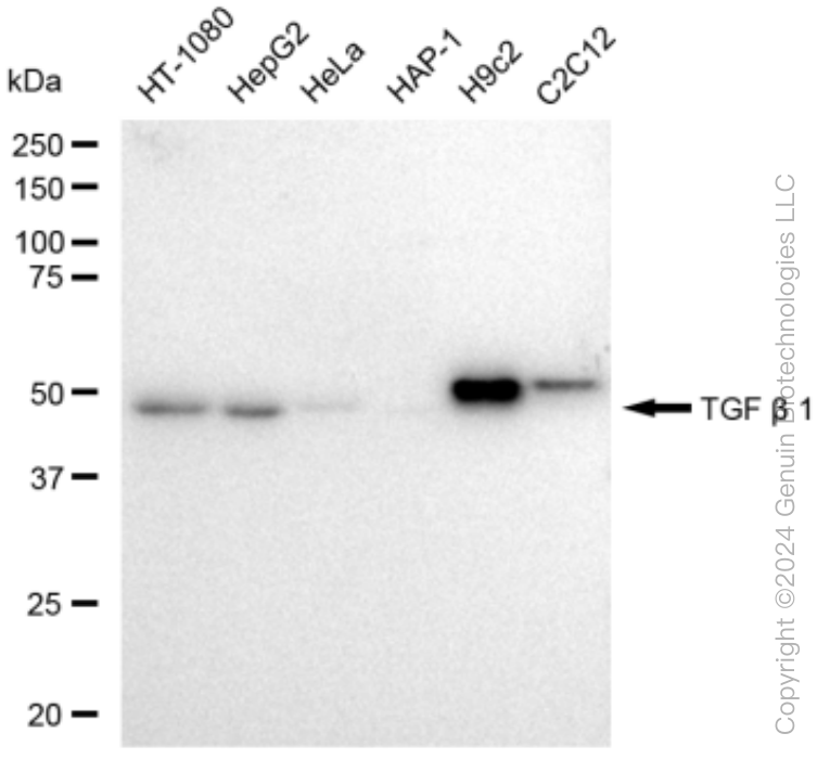 KD-Validated Anti-TGF beta 1 Rabbit Monoclonal Antibody ABG1489