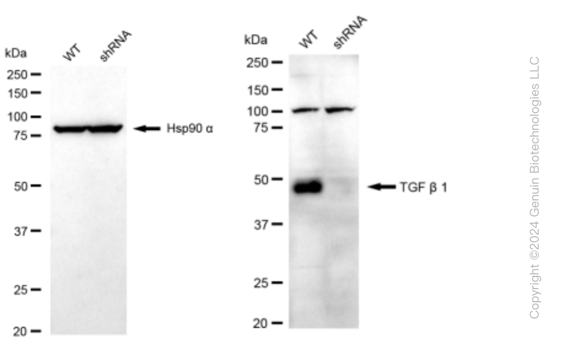 KD-Validated Anti-TGF beta 1 Rabbit Monoclonal Antibody ABG1489
