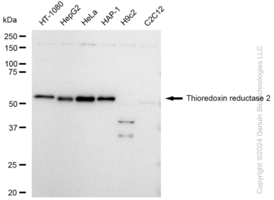 KD-Validated Anti-Thioredoxin reductase 2 Rabbit Monoclonal Antibody ABG1491