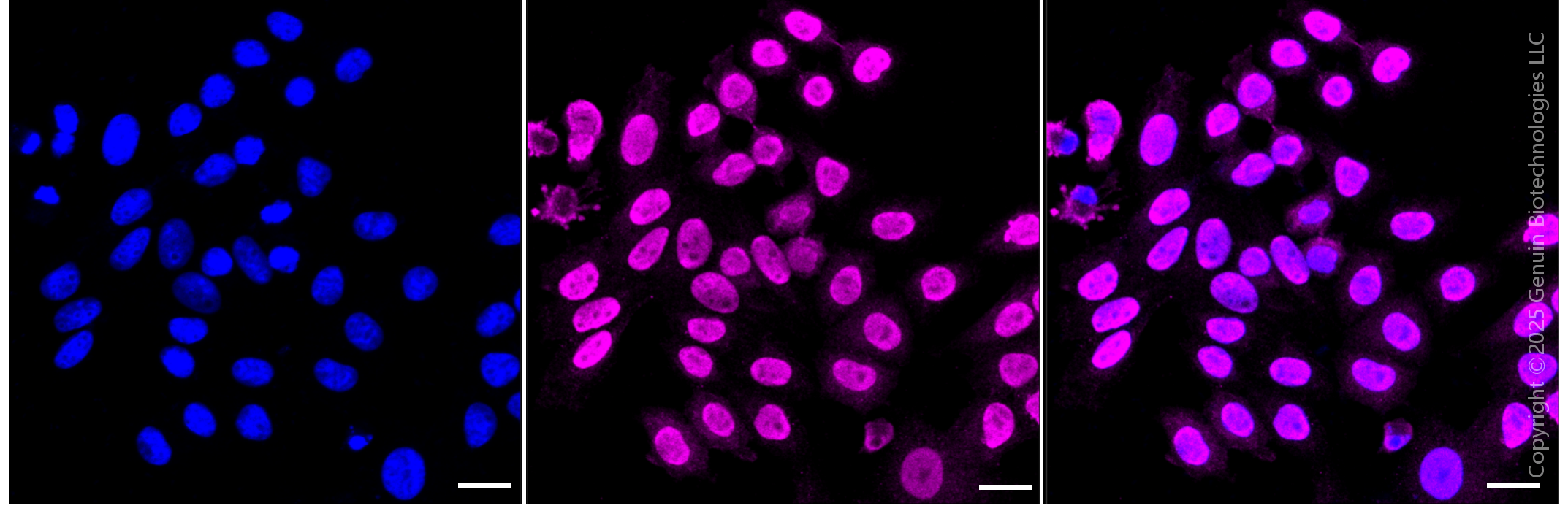 KD-Validated Anti-Ku70 Rabbit Monoclonal Antibody ABG1493