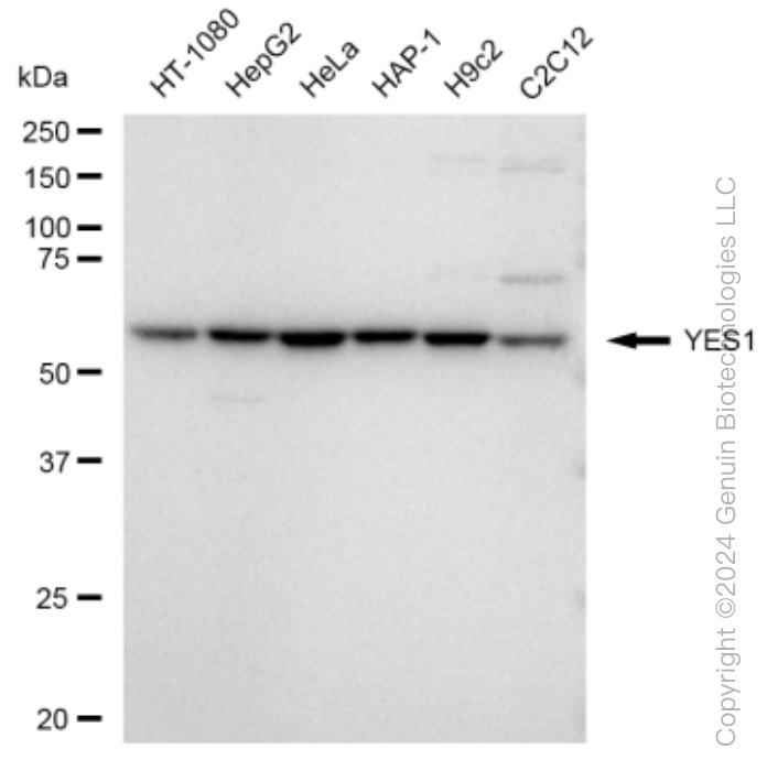 KD-Validated Anti-YES1 Rabbit Monoclonal Antibody ABG1494