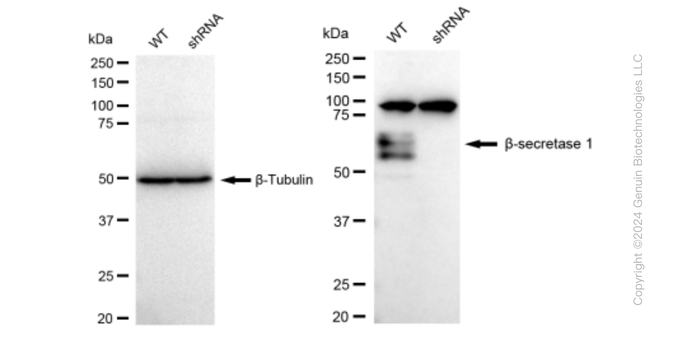 KD-Validated Anti-Beta-secretase 1 Rabbit Monoclonal Antibody ABG1497