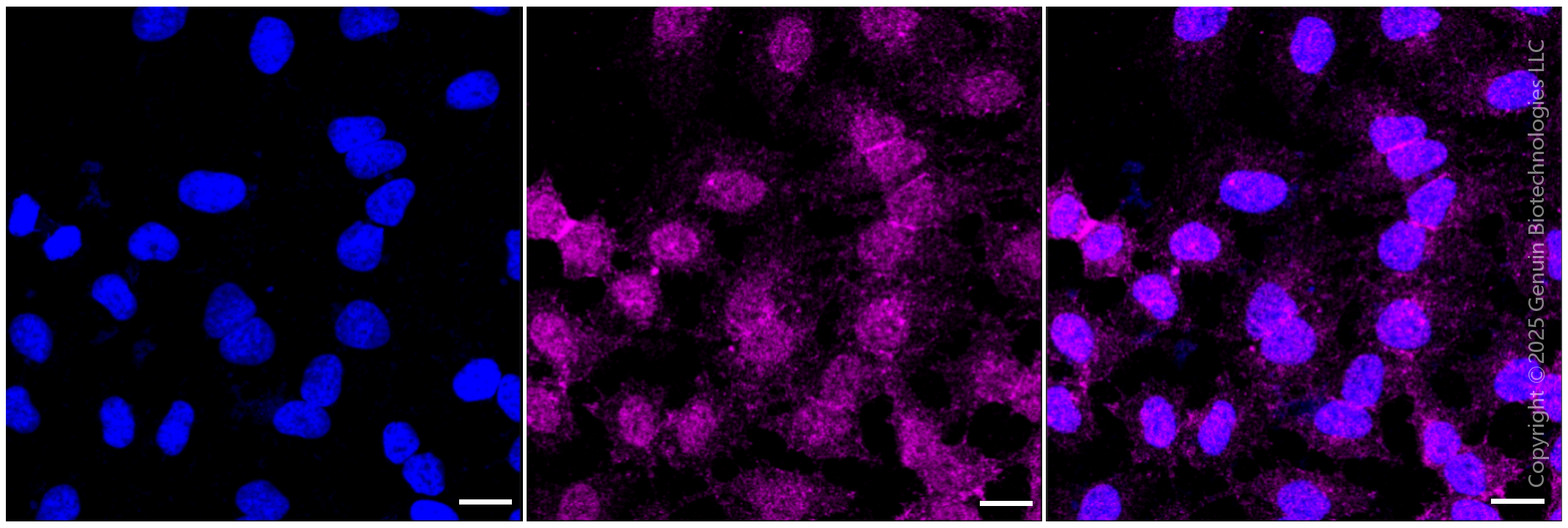 KD-Validated Anti-CD276 Rabbit Monoclonal Antibody ABG1498