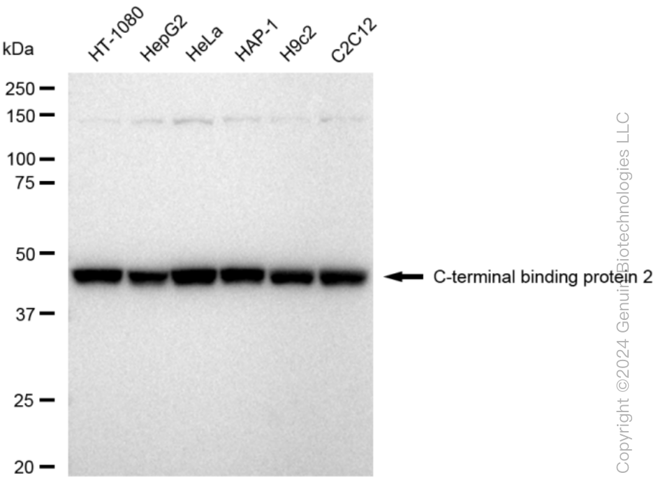 KD-Validated Anti-C-terminal binding protein 2 Rabbit Monoclonal Antibody ABG1500