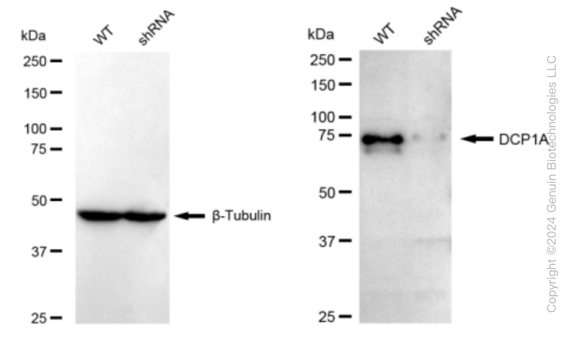KD-Validated Anti-DCP1A Rabbit Monoclonal Antibody ABG1502