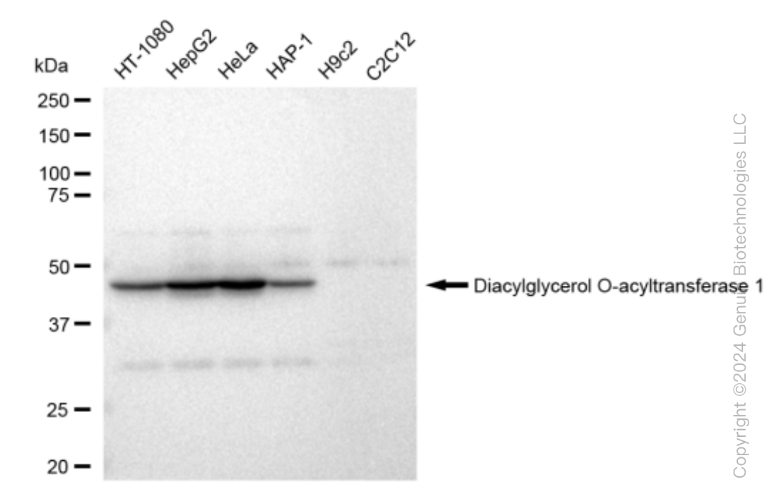 KD-Validated Anti-Diacylglycerol O-acyltransferase 1 Rabbit Monoclonal Antibody ABG1503