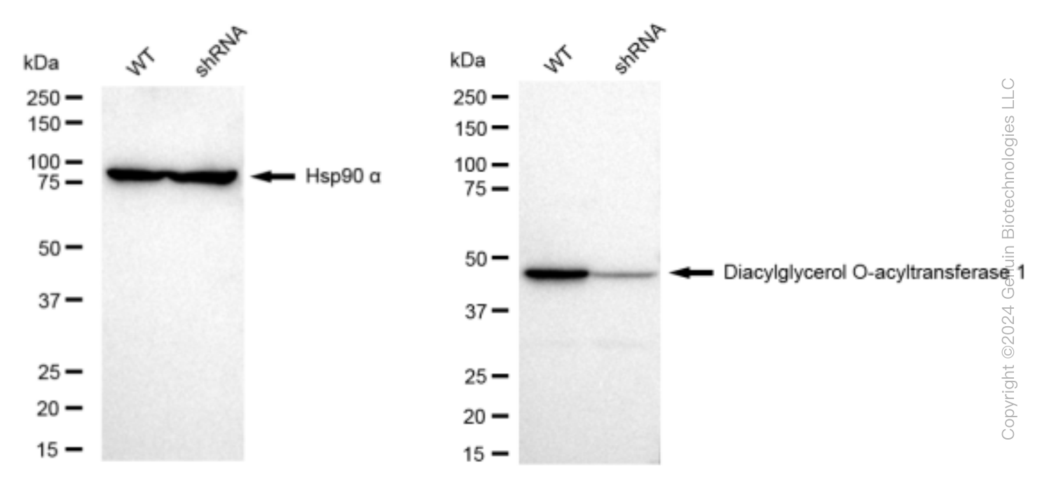 KD-Validated Anti-Diacylglycerol O-acyltransferase 1 Rabbit Monoclonal Antibody ABG1503