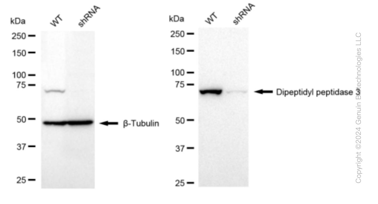 KD-Validated Anti-Dipeptidyl peptidase 3 Rabbit Monoclonal Antibody ABG1505